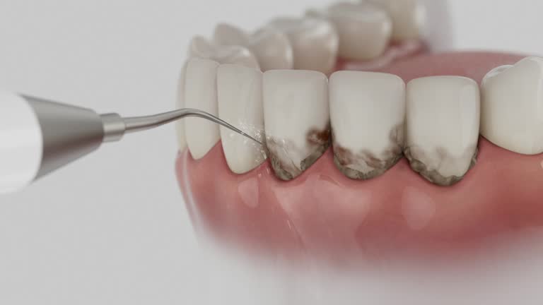 Reliable Dental contractor in Clarke County County, MS by Dentist Open Now